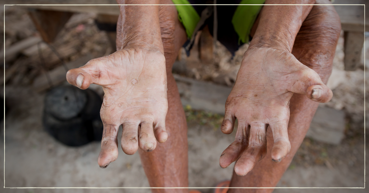 6th Week of Ordinary Time: The Leprosy of Sin
